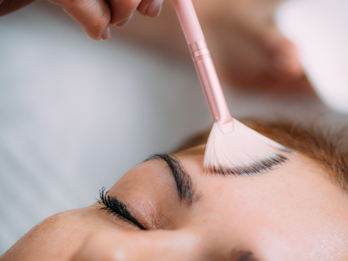 VI Peel: What It Is, How It Works, and Why May Is the Perfect Time to Refresh Your Skin
